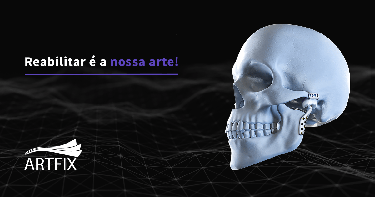 Artfix